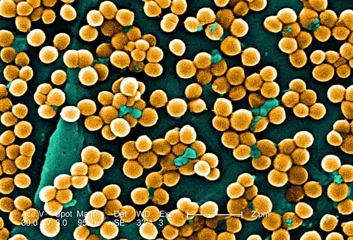 Staphylococcus aureus bacteria (Coccus)