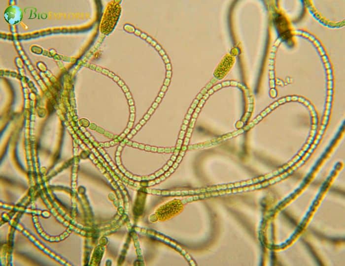 Cyanobacteria Micrograph