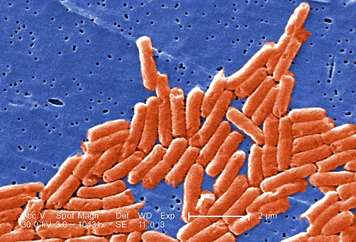 Salmonella sp bacteria (Rod-Shaped)
