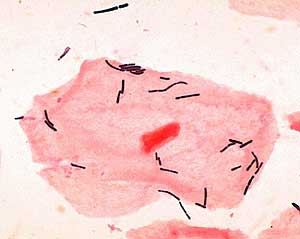 Lactobacillus bacteria
