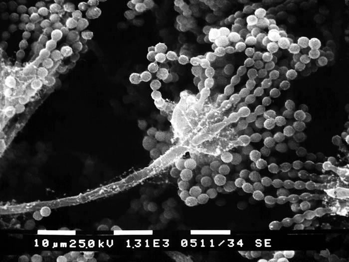 Close-up of Asexual Aspergillus Fungi
