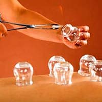 Cupping Therapist
