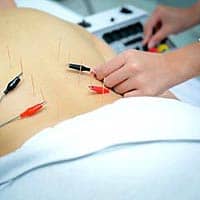 Electroacupuncture Practitioner