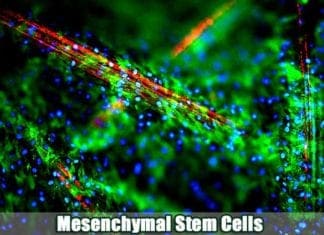 Mesenchymal Stem Cells