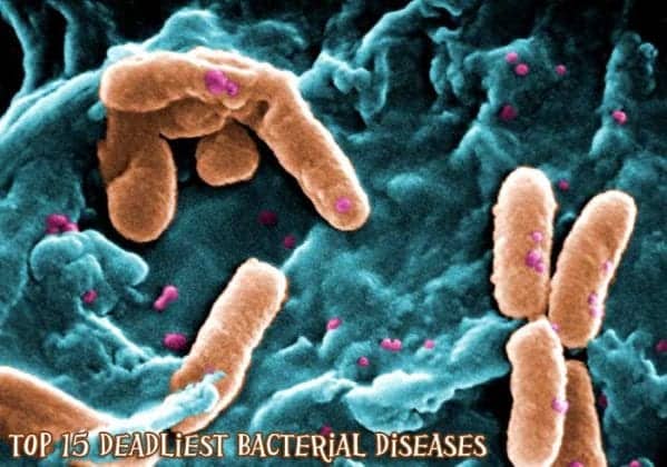 Bacterial Diseases | Top 14 Most Deadliest Diseases Caused By Bacteria