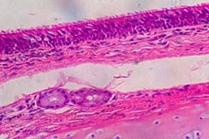 nonciliated pseudostratified columnar epithelium