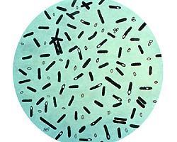 Clostridium botulinum