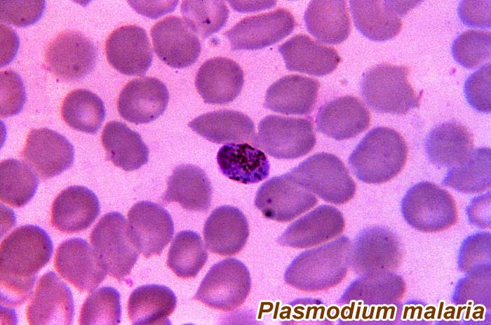 Plasmodium malaria