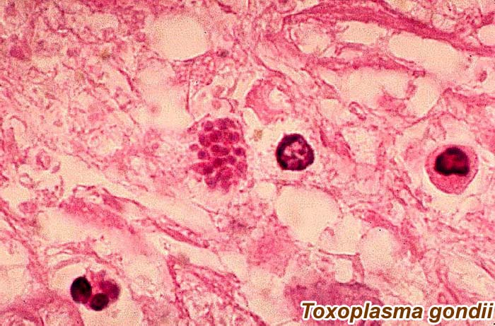 Toxoplasma gondii