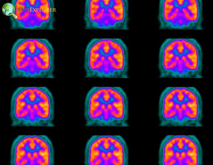 Positron Emission Tomography (PET)