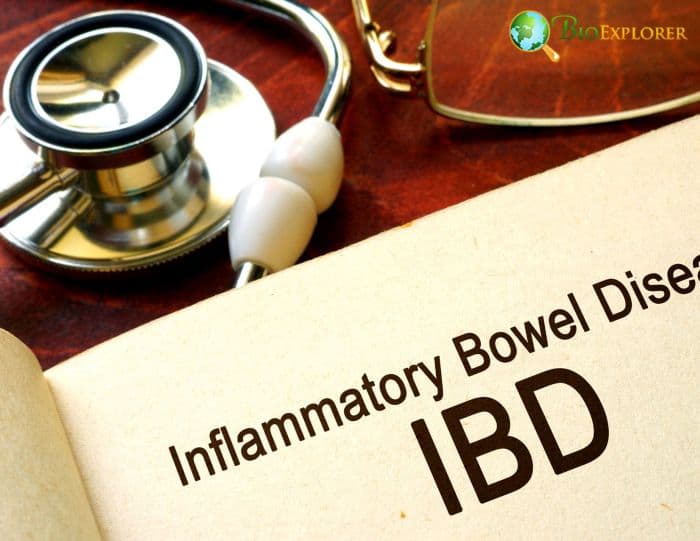 Inflammatory Bowel Disease