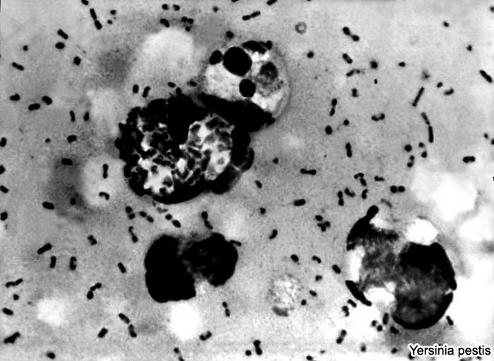 Yersinia pestis causes Bubonic Plague