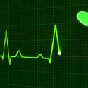 cardiac electric system