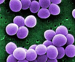 Staphylococcus aureus