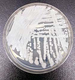 Candida Auris