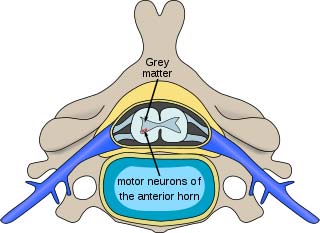 Spinal muscular atrophy