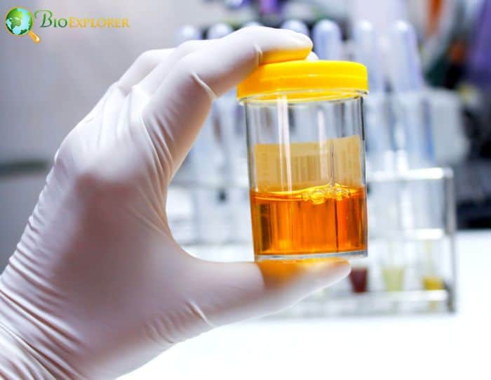 Urine Sample