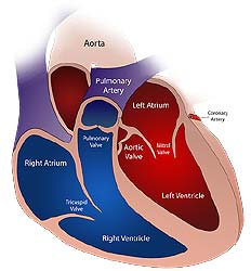 heart surgery