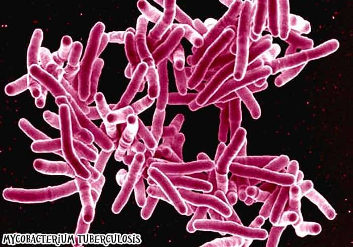 Mycobacterium tuberculosis causes TB.