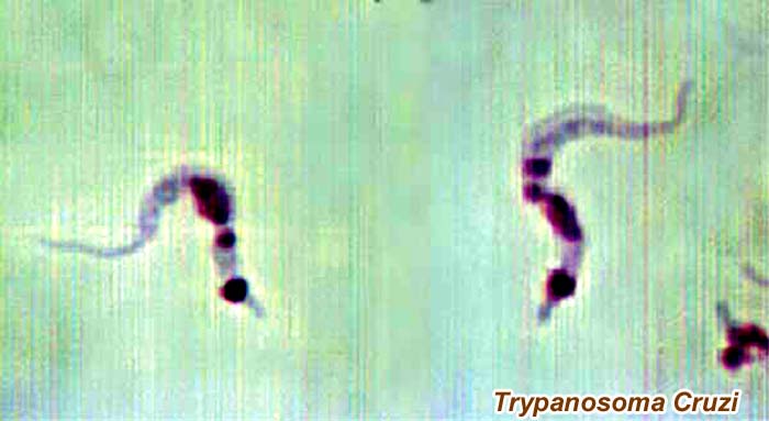 Trypanosoma Cruzi