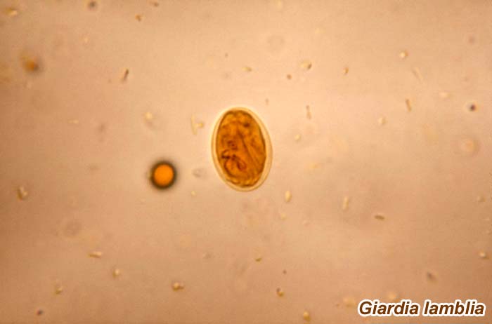 Giardia lamblia