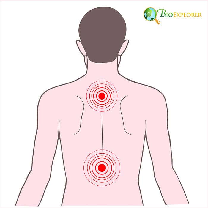 Pain Perception