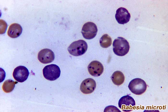 Babesia microti