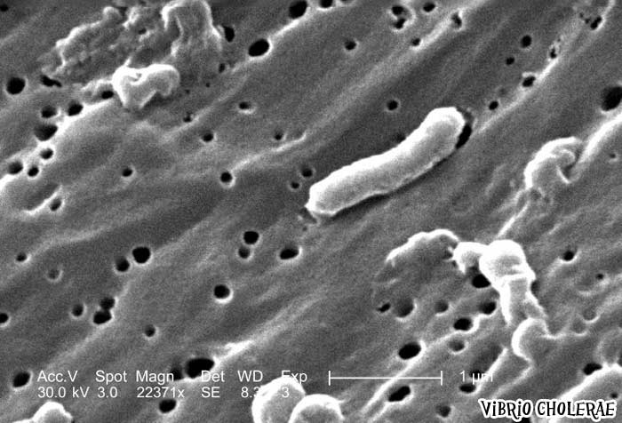 Vibrio cholerae causes Cholera