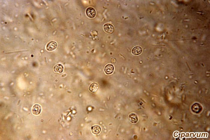 Cryptosporidium parvum