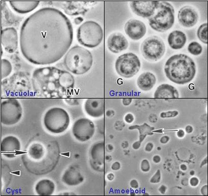 Blastocystis hominis