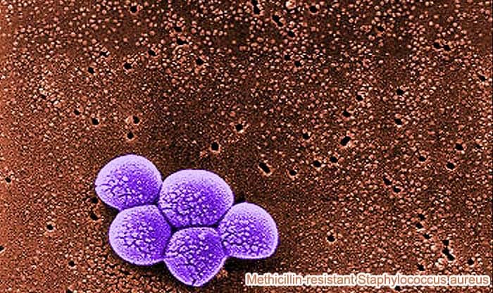 MRSA causes MRSA Infection