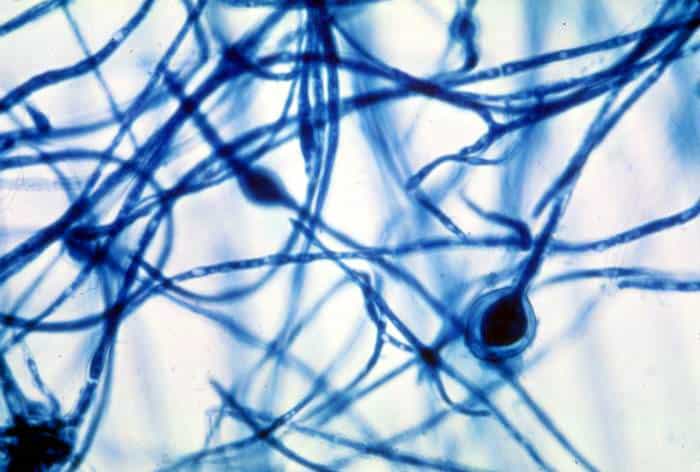 Chlamydospores of the Fungus