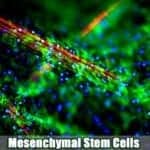 Mesenchymal Stem Cells