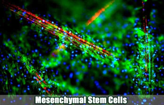 Mesenchymal Stem Cells