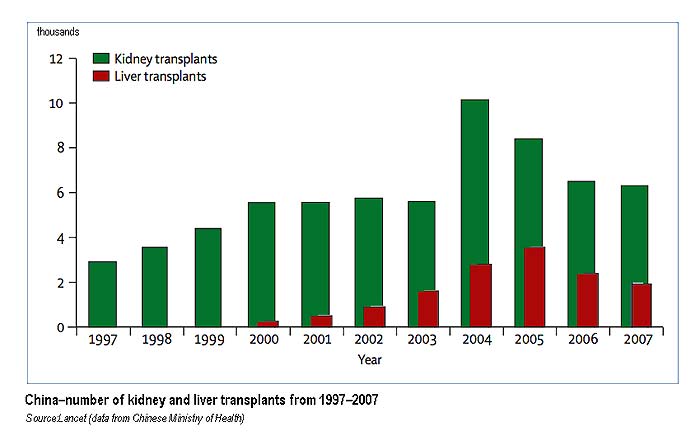 Organ Donation