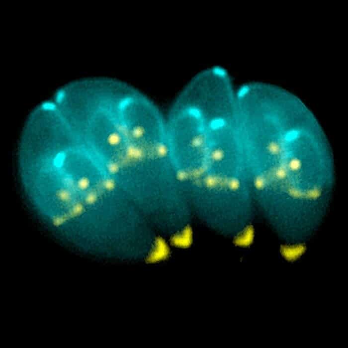 Toxoplasma_Gondii