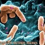 Bacterial Diseases