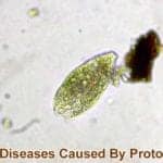 diseases caused by protozoa