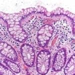 Goblet Cells