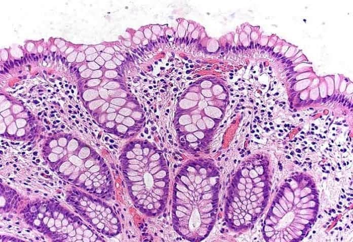 Goblet Cells