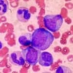 Hematopoietic Stem Cells (White Blood Cells) in Bone Marrow