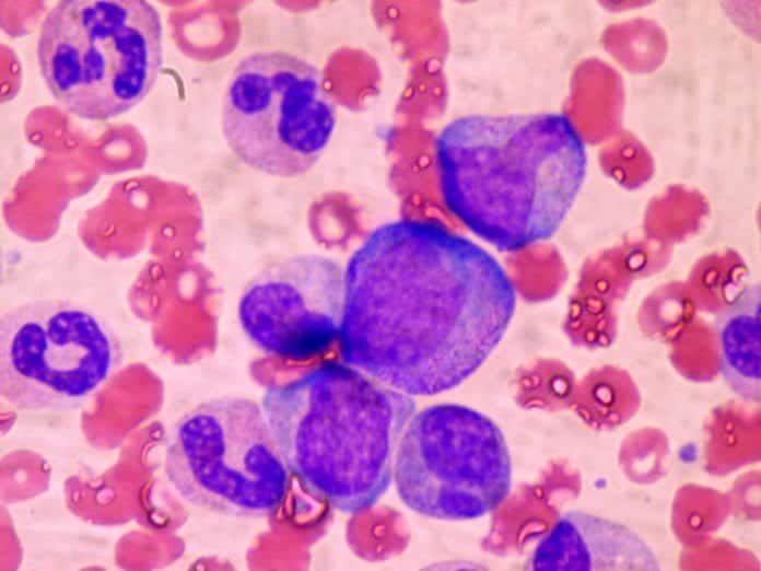 Hematopoietic Stem Cells (White Blood Cells) in Bone Marrow