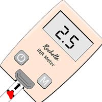 Blood Glucose