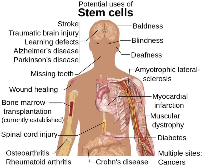 Stem Cell Benefits