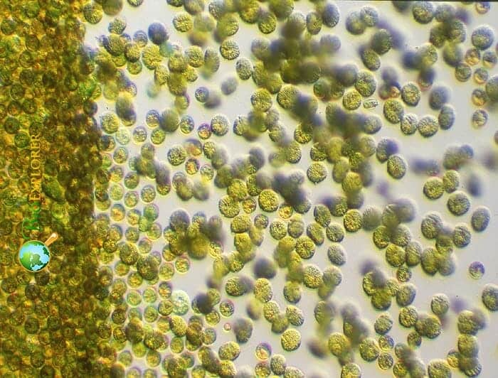 Toxic Gold Algae In Algal Bloom Under The Microscope